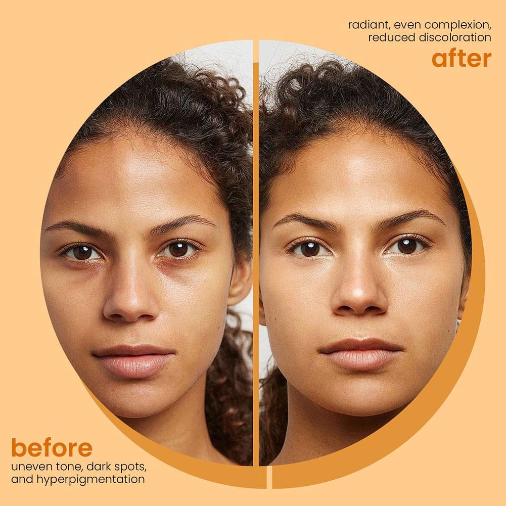 100g de savon à la main au curcuma, savon à l’acide kojique au citron, savon pour la douche et le visage Nettoyage en profondeur pour les soins de la peau du visage et du corps