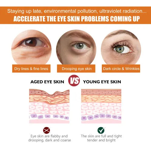 EELHOE Curcuma Crème pour les yeux Curcuma Vitamine C Crème hydratante pour les yeux pour réduire les lignes des yeux et soin de la peau.