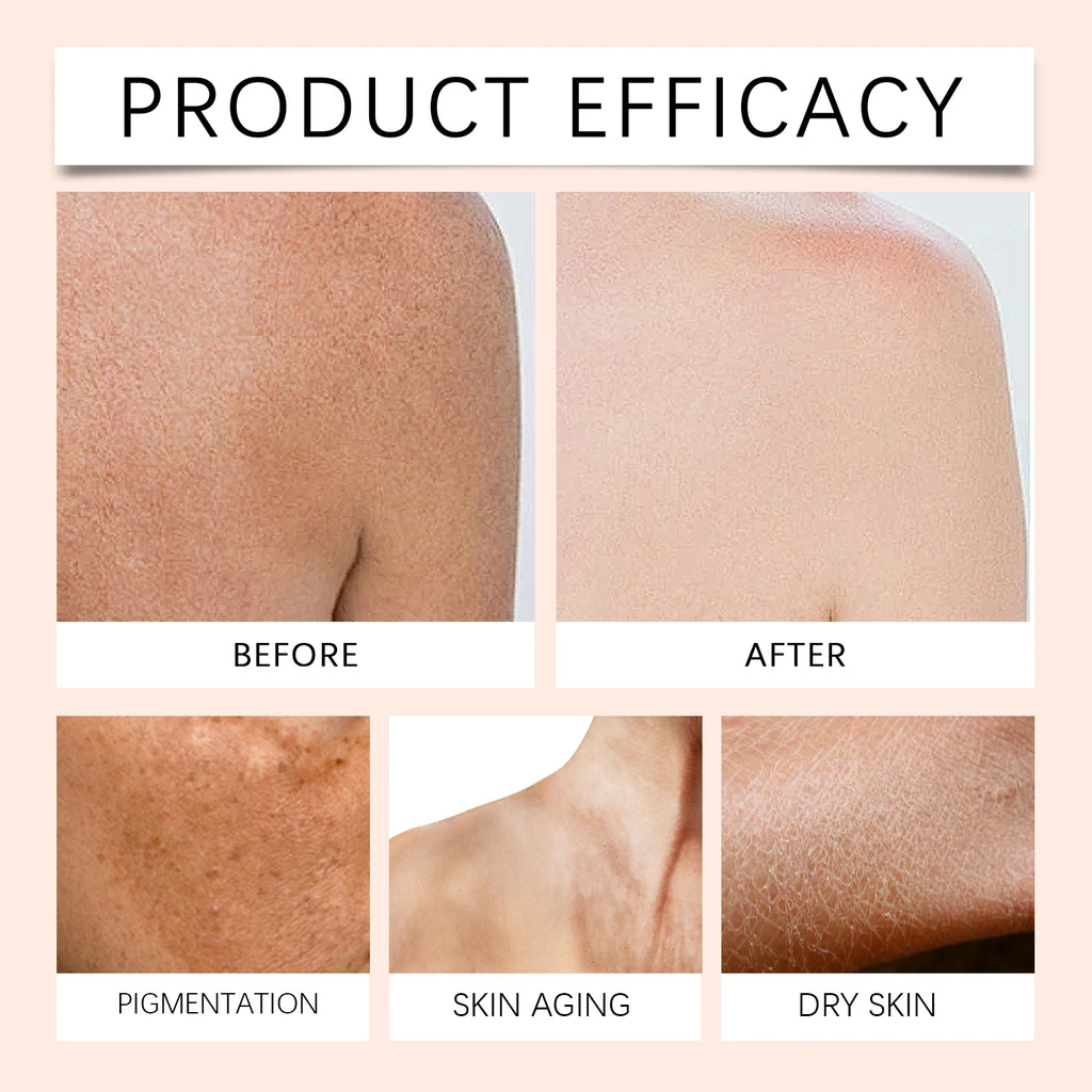 Huile corporelle de rose 100 ml Huile d’argan marocaine Vitamine E Hydratant intense pour les peaux sèches Huile de massage nourrissante Soins corporels de luxe rapides