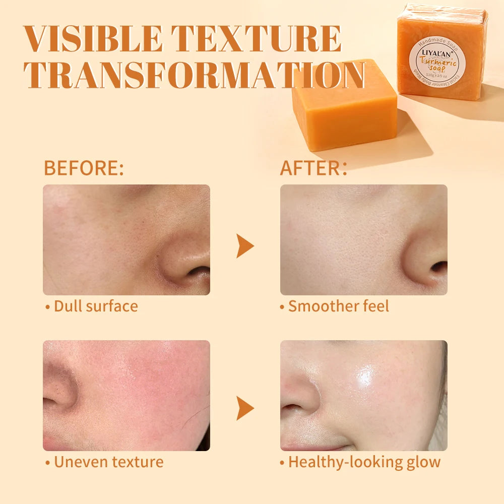 2pcs Savon au curcuma Nettoyage du visage Ton de la peau lisse éclatant Peau éclaircie Apaise Bain corporel Savon pour le visage fait à la main Soins de la peau