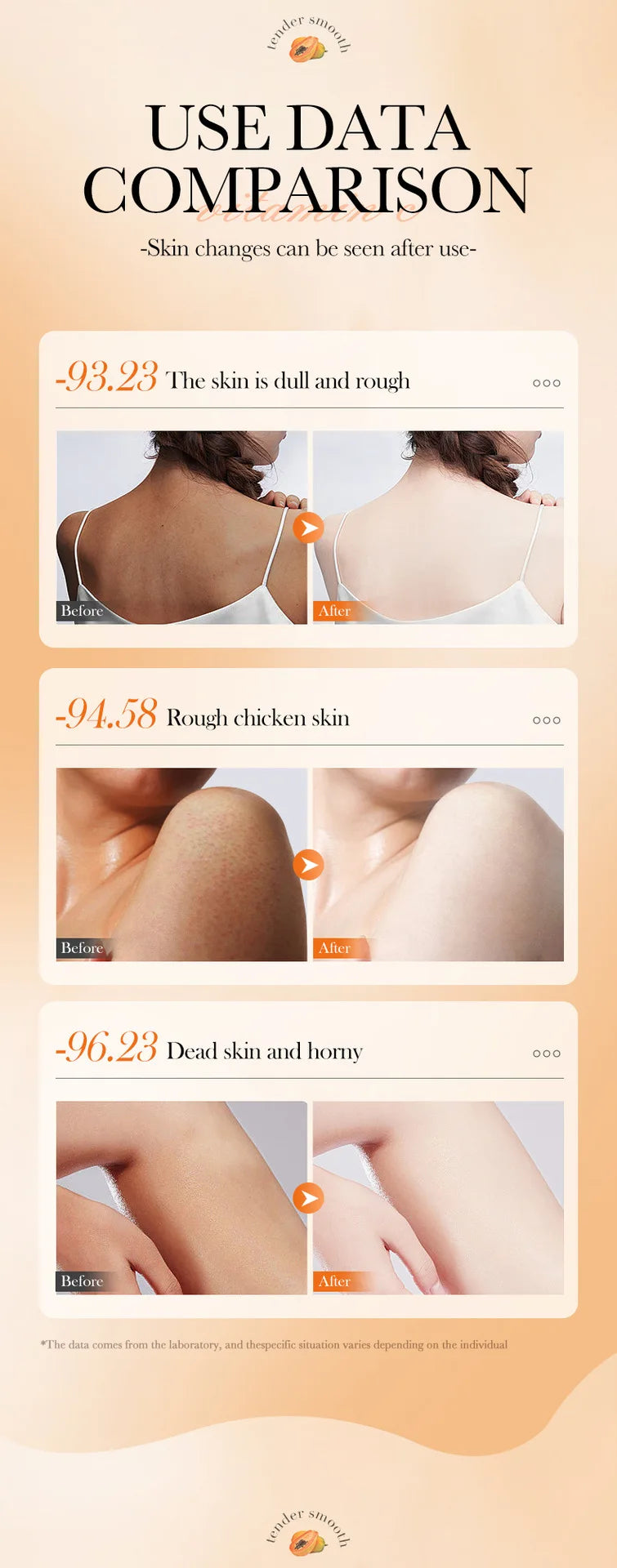 Crème Gommage Exfoliante Papaye Vitamine C 100g - Hypoallergénique Hydratante Nettoyage Profond