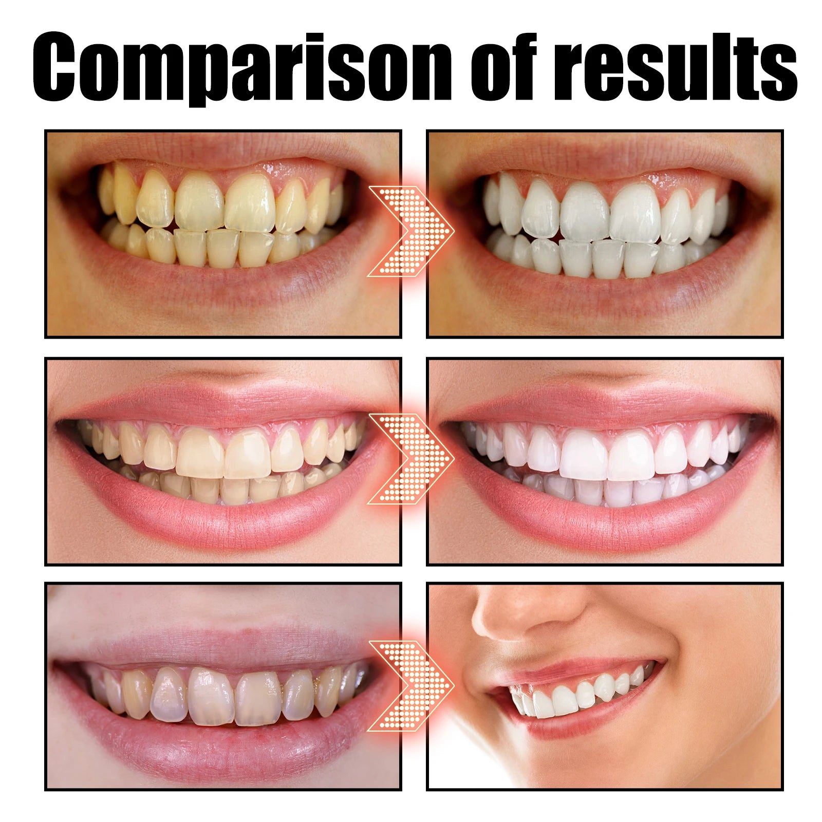 Kit Bain de Bouche à l'Huile de Coco et Menthe avec Gratte-Langue - Soin Bucco-Dentaire Complet