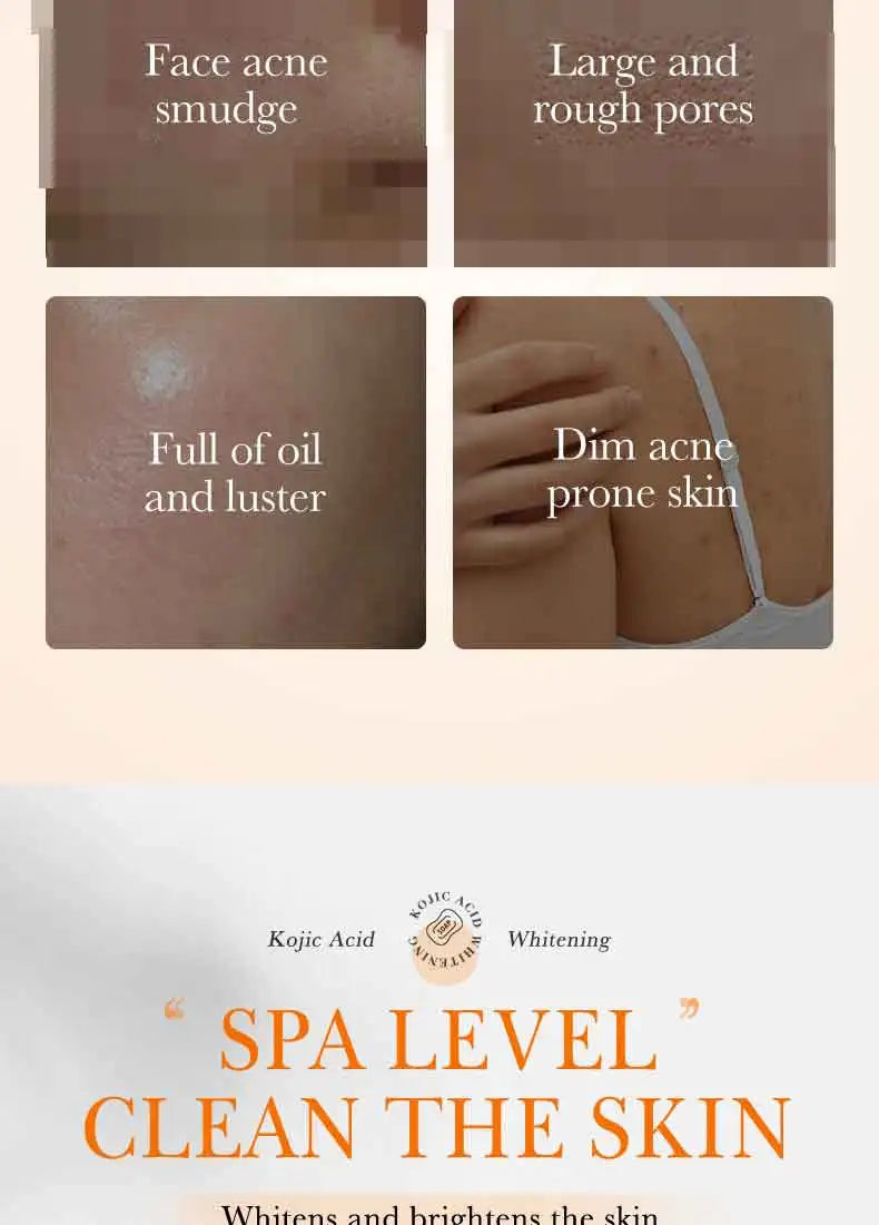 Savon Artisanal Éclaircissant Acide Kojique - Nettoyage Profond Hydratant Huile Essentielle Doux