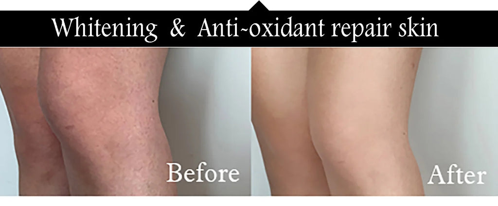 Kit de soins de la peau AILKE Collagen 5 en 1, restaurer l’élasticité de la peau, lisser la peau, éclaircir, unifier le teint de la peau, pour l’utilisation du visage et le corps