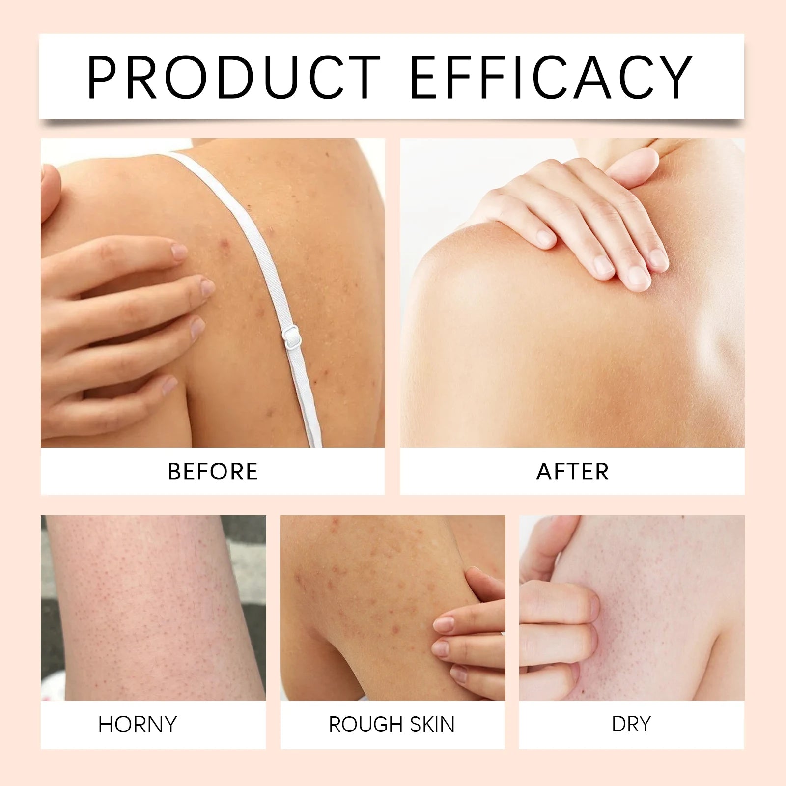 Gel Douche Éclaircissant Papaye - Exfoliant Atténue Pigmentation Parfum Durable Contrôle Sébum Hydratant Mousse Riche