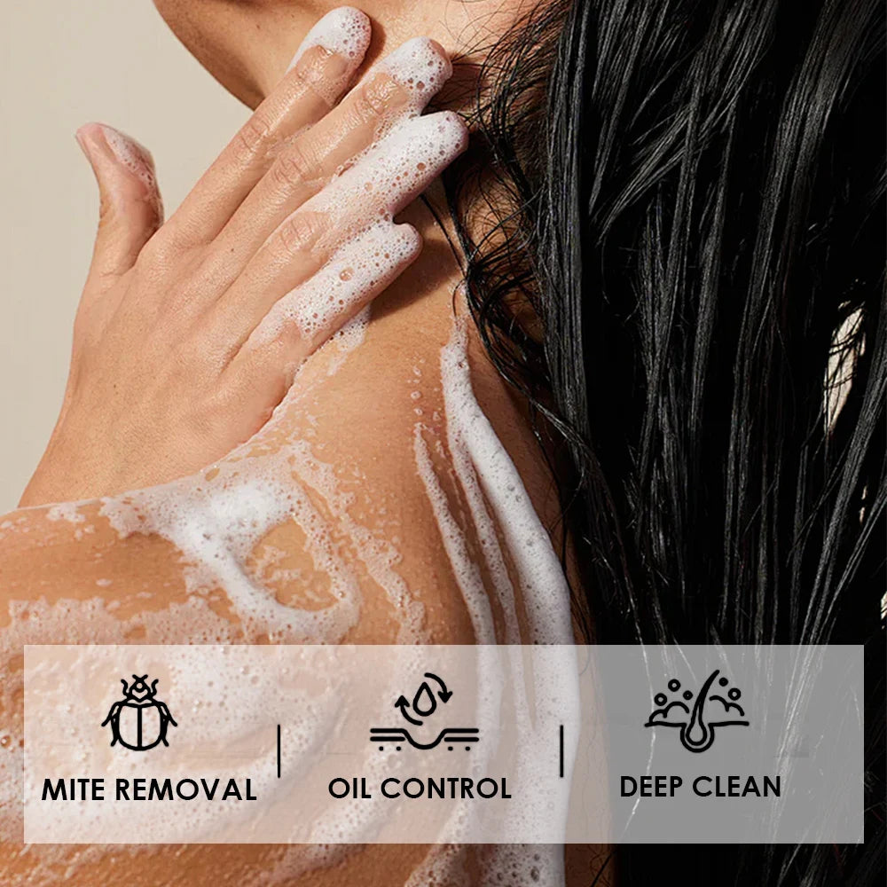 Savon au curcuma, acides au citron, fait à la main, acide kojique, barre de soin naturelle pour hydrater et exfolier le corps et le visage, 5 pièces