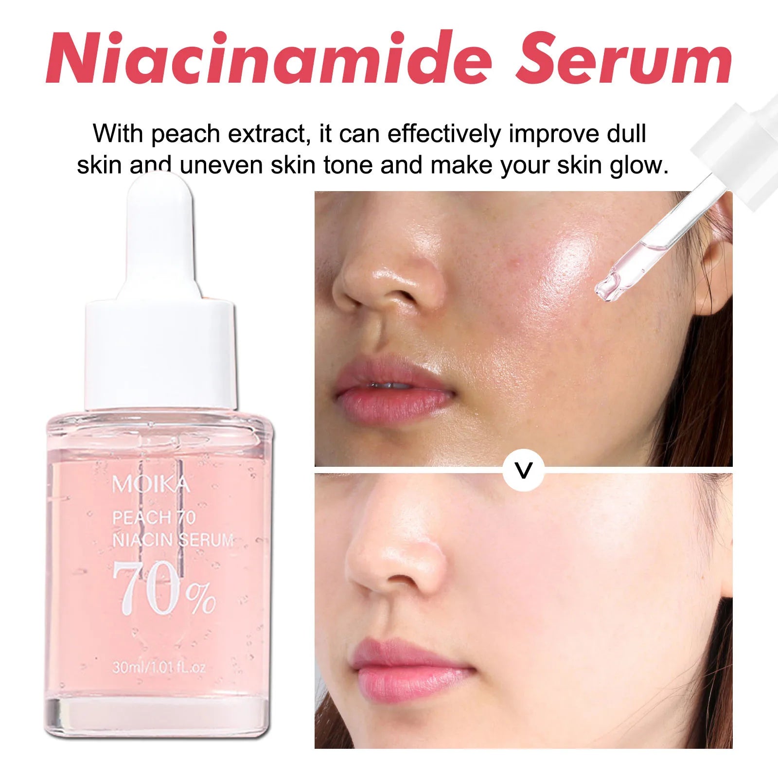 Niacinamide Serum Dark Spot Remover Fade Acne Marks Hyperpigmentation Shrink Pores Even Skin Tone Moisturizing Korea Skin Care 3