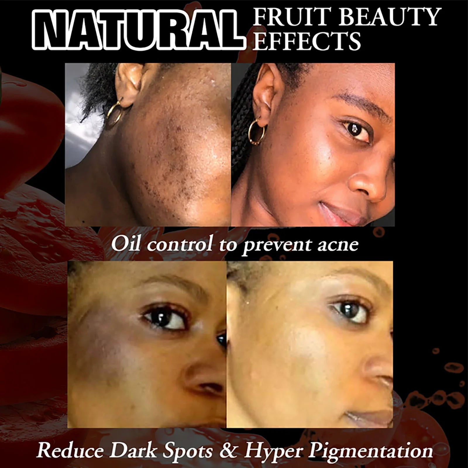 Savon Éclaircissant Tomate Bio - Unifie le Teint 200g