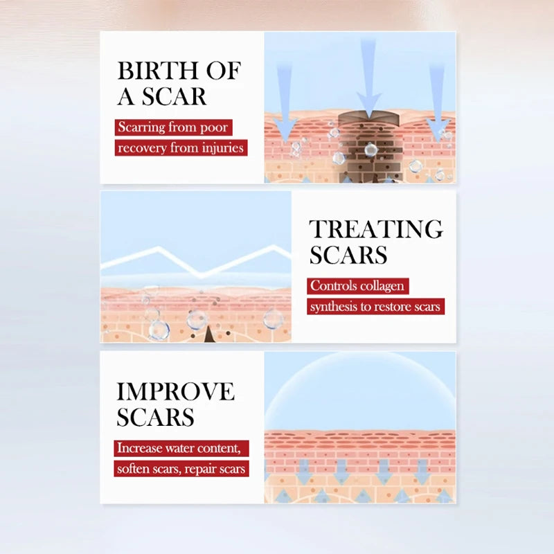 Crème Réparatrice Cicatrices et Brûlures - Hydratation Intense