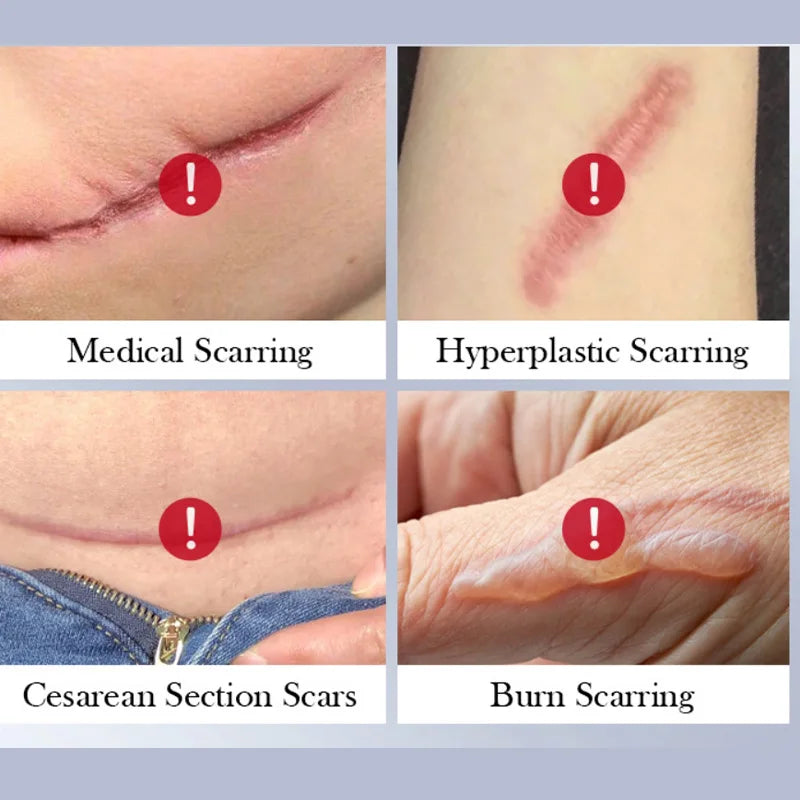 Crème Réparatrice Cicatrices et Brûlures - Hydratation Intense