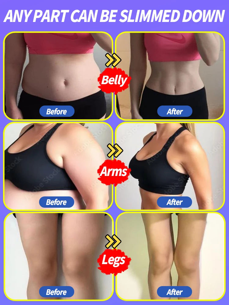 Crème minceur à l'extrait végétalingrédients sûrscombustion efficace des graissesadaptée à une utilisation pour tout le corps
