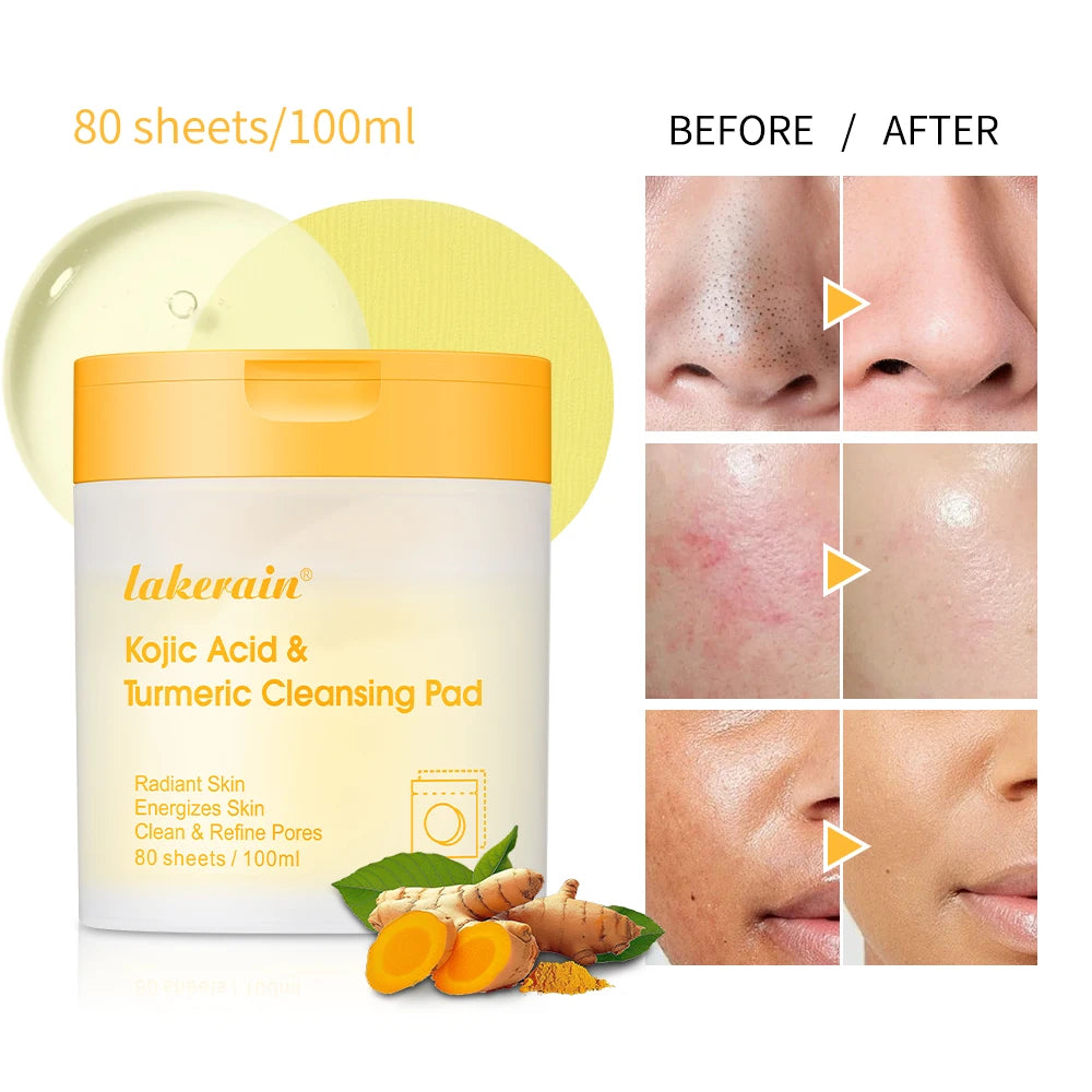 80 tampons nettoyants au curcuma Les tampons nettoyants à l’acide kojique aident à équilibrer l’huile de la peau et l’eau Éliminer l’excès de kératine du corps